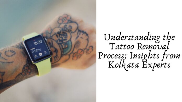 Understanding the Tattoo Removal Process: Insights from Kolkata Experts