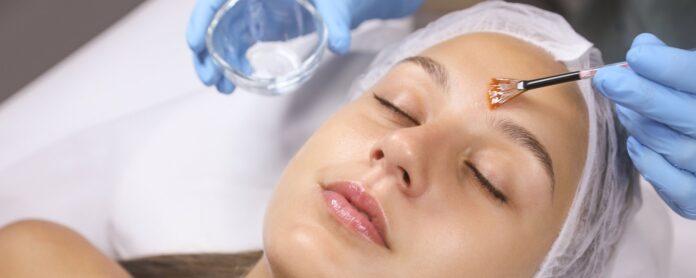 Chemical Peels